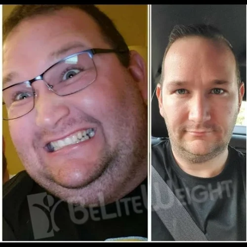 Steven M - 24 Month Update*